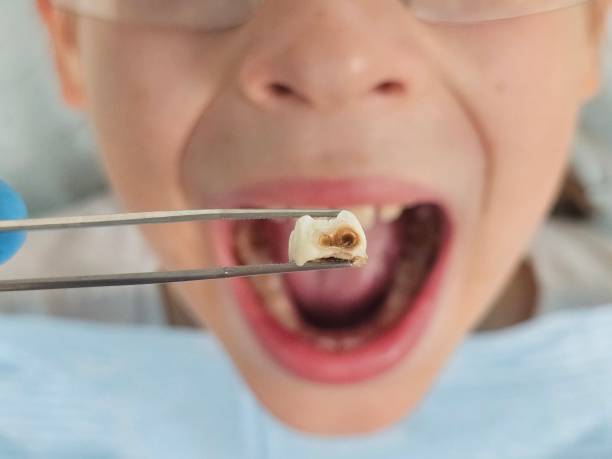 Best Emergency Gum Treatment in Halstead, KS